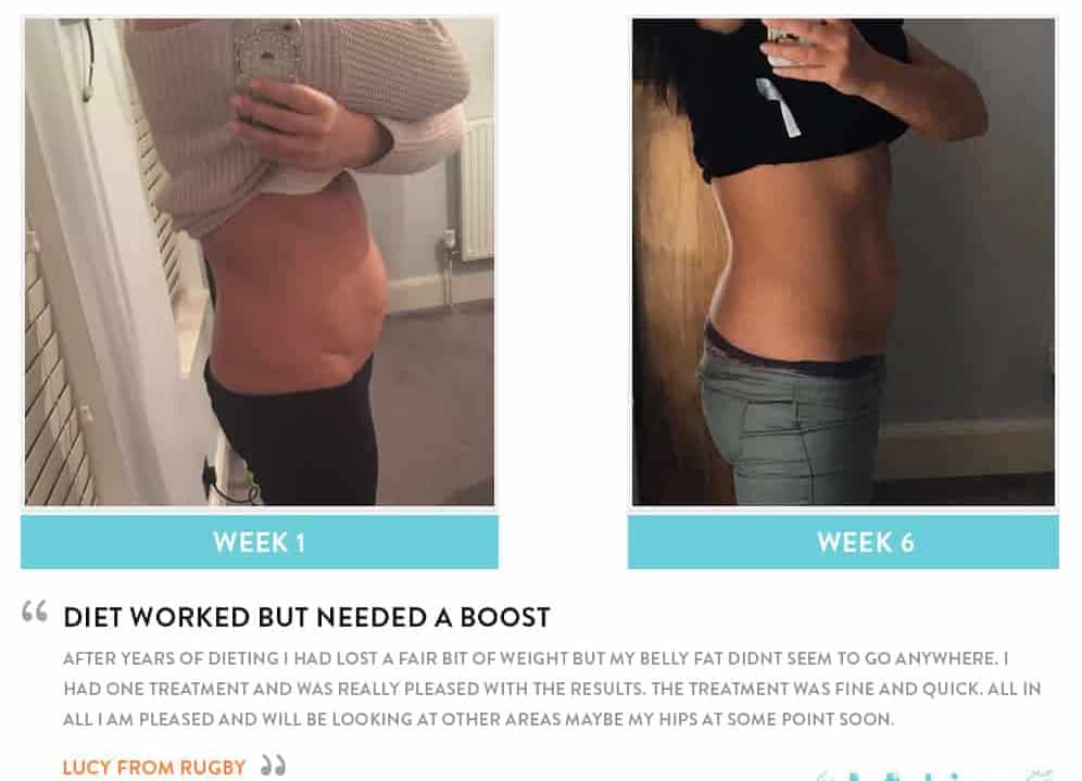 Before and After Dieting Burgess Hill