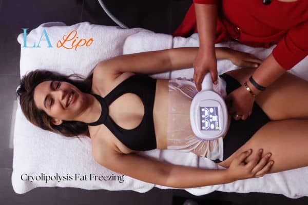woman getting cryolipolysis Burgess Hill