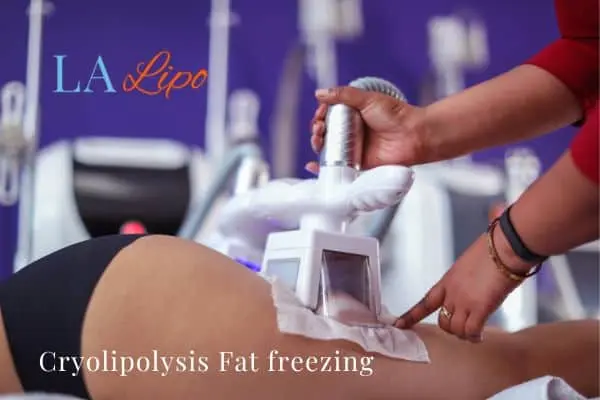 women getting fat freezing Burgess Hill