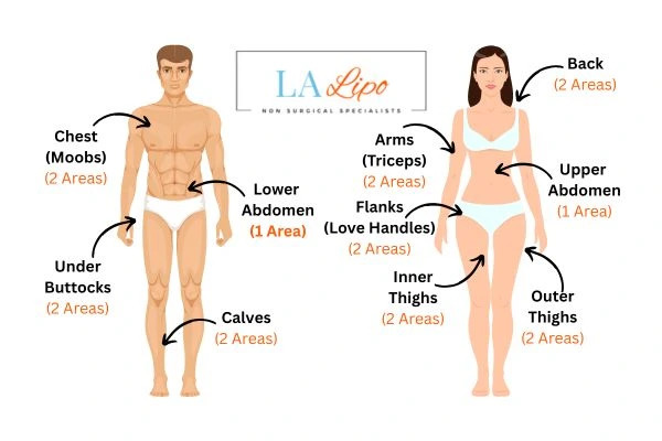 LA LIPO Cryolipolysis Areas Burgess Hill