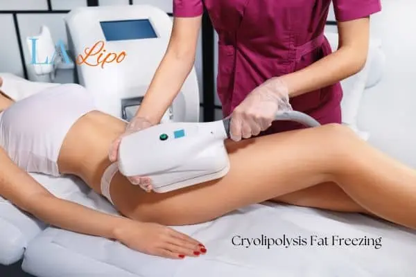 Woman receiving coolsculpting Burgess Hill treatment on her thighs