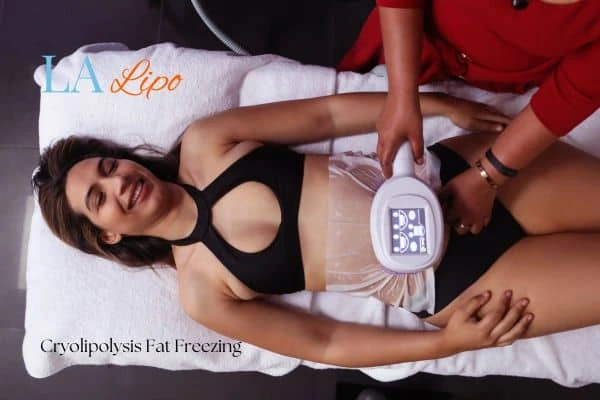woman getting cryolipolysis Burgess Hill
