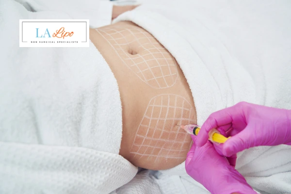 aqualyx fat dissolving injections Burgess Hill