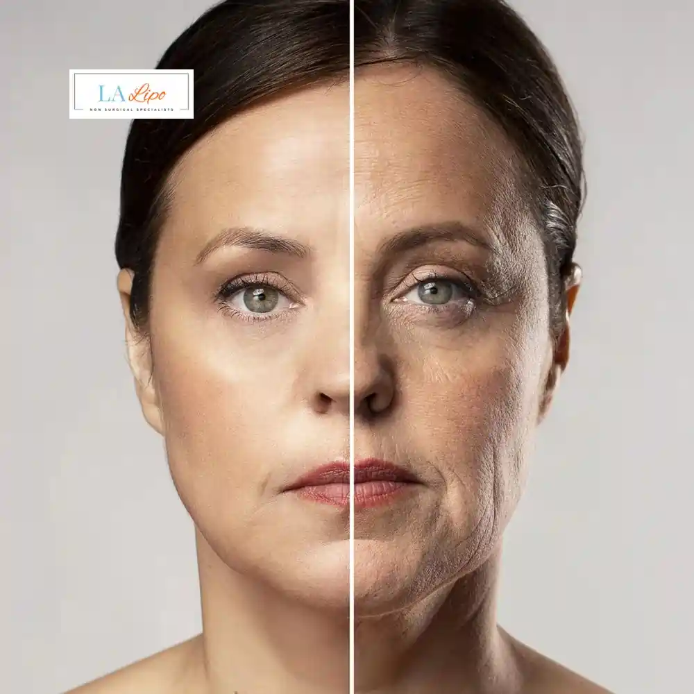 How Can You Tell If Non-Surgical Skin Tightening Is Right for You Burgess Hill?